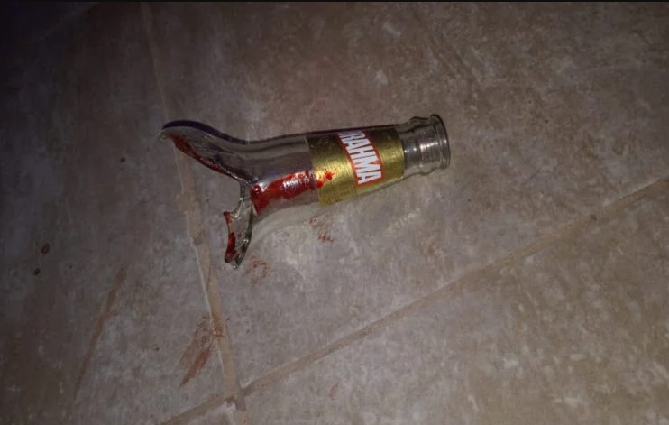 Fue al casino a jugar y tras ser atacado terminó con la cara cortada