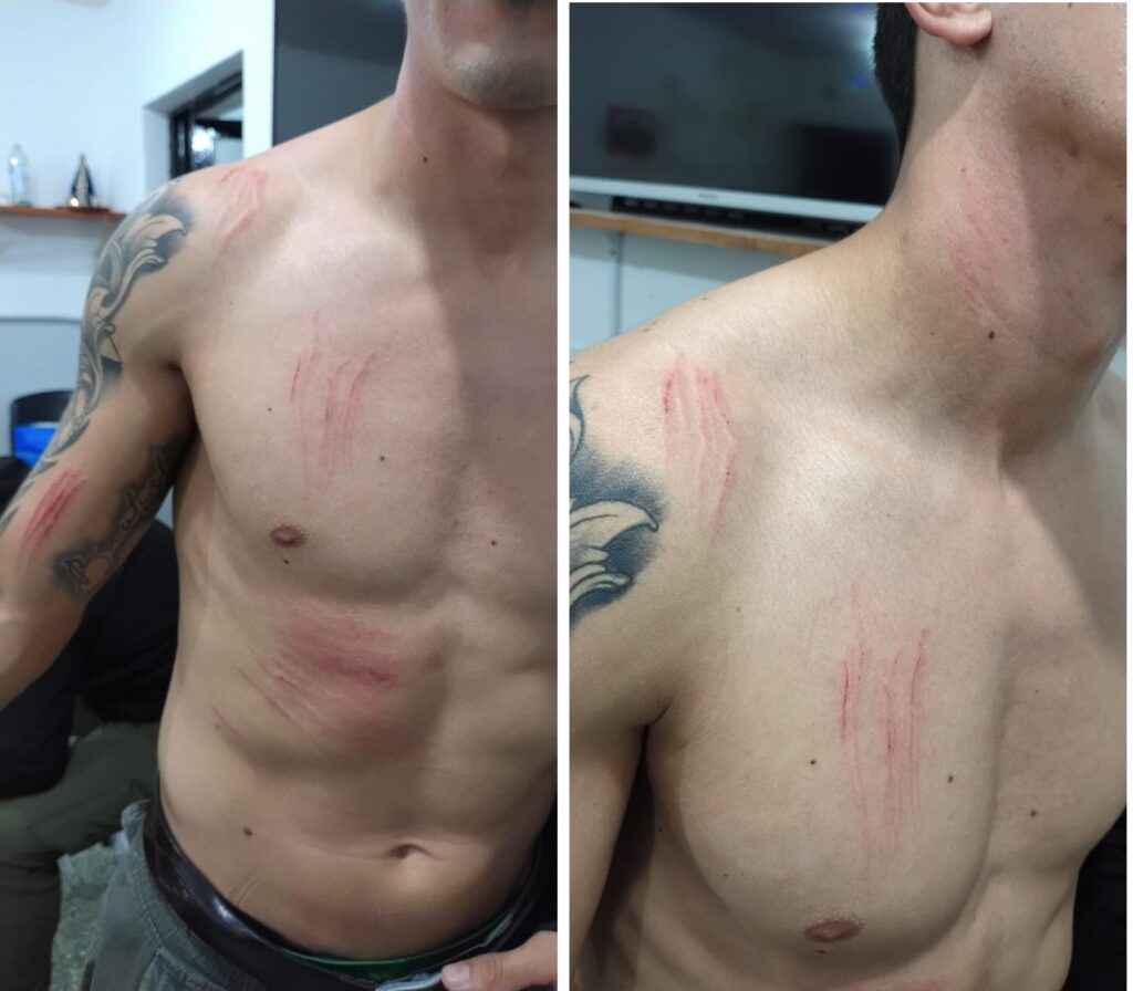 Resistencia: detienen a un hombre tras agredir a un policía y causar daños a su vehículo