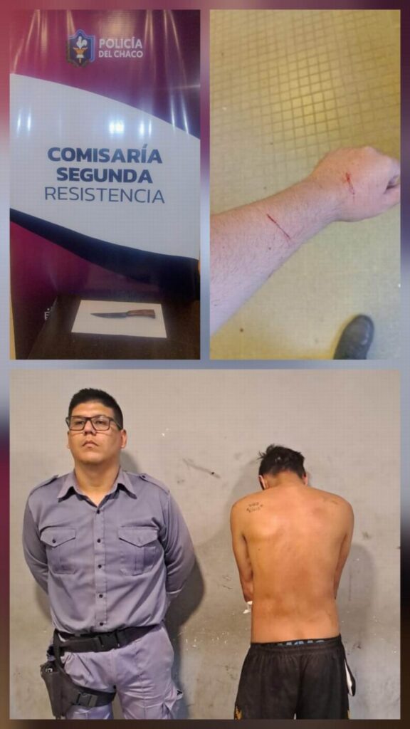 Enloquecido, provocó líos y lesionó a un agente