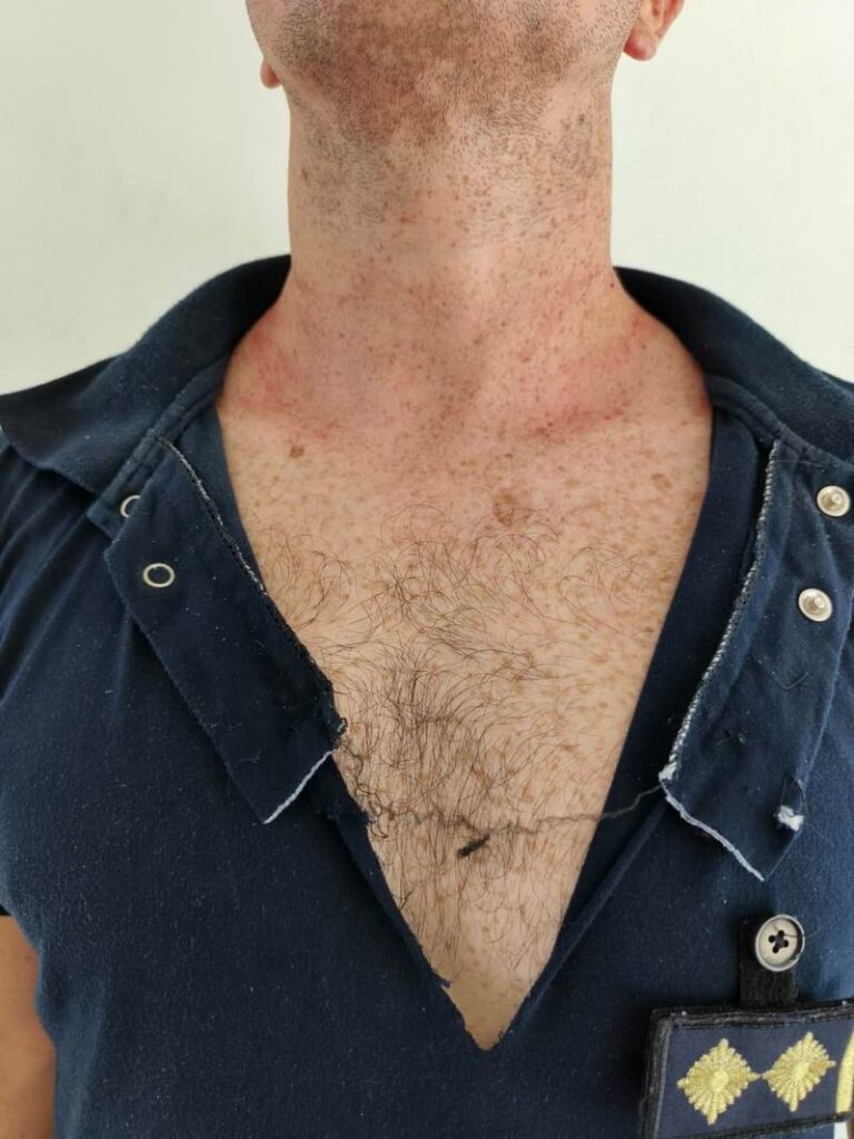 Sargento quiso asfixiar al comisario del pueblo