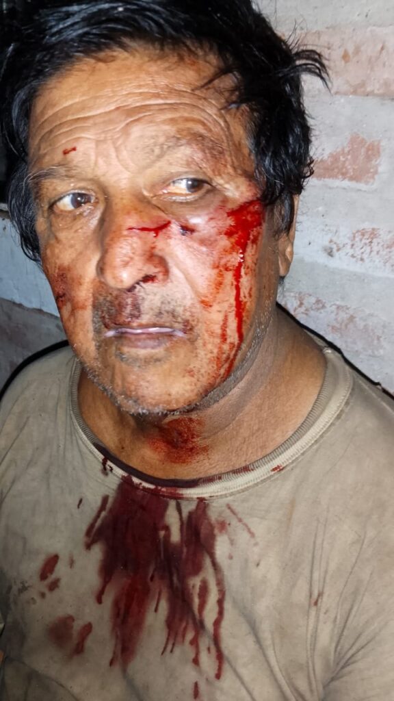 Desfiguró a un abuelo pero quedó libre por lesiones leves