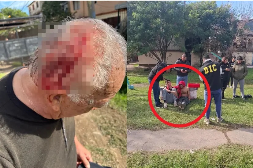 Violencia sin límites: atacaron a cuchillazos a un jubilado para robarle el celular