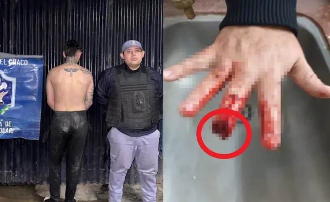 Policía perdió un dedo atacado por Hanníbal Lecter