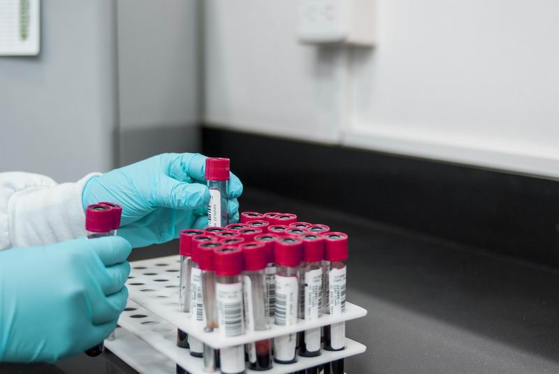 Alarma sanitaria: la sífilis se dispara con un aumento del 75% de casos en el país