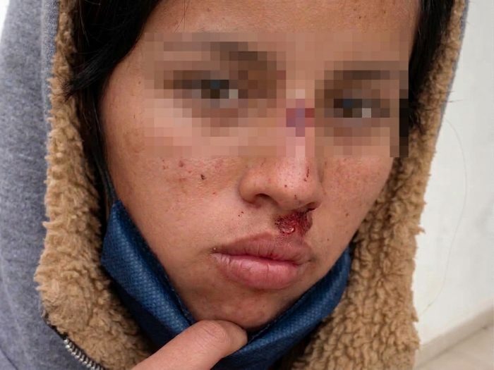 En octubre se inicia el juicio contra diez policías de Fontana