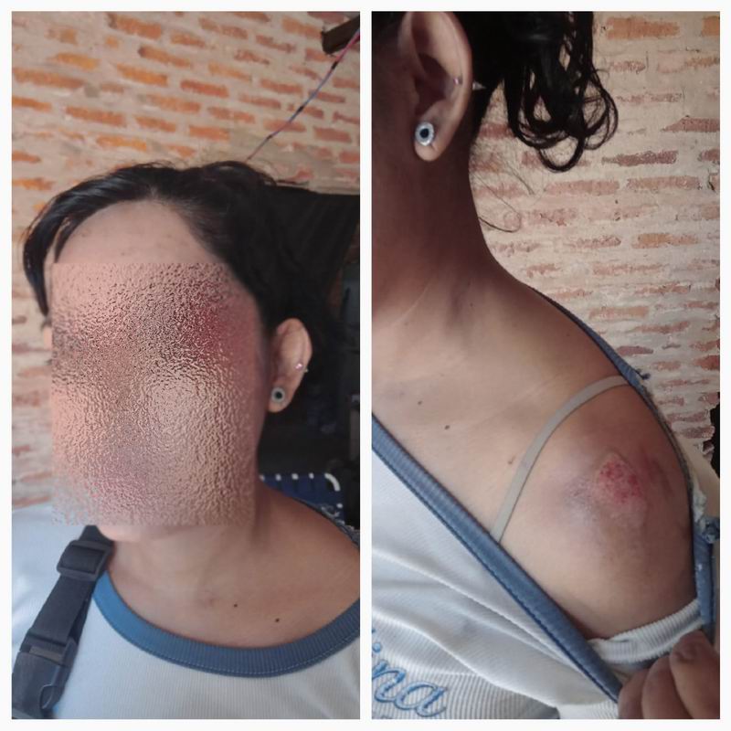 Fue agredida y no le habrían tomado la denuncia