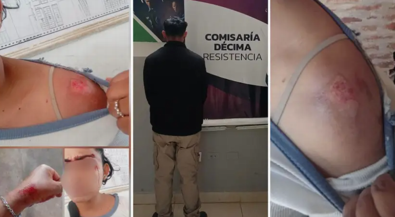Tenía una restricción de acercamiento, atacó a su ex y terminó detenido