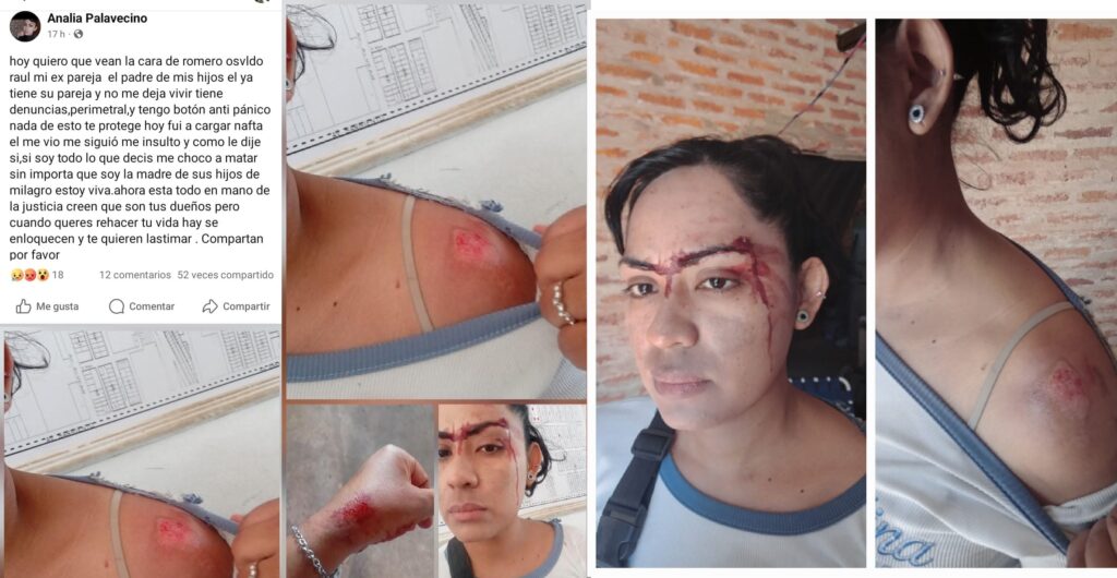VIOLENCIA DE GÉNERO| Apretó el botón antipánico después de caer de la moto: denunció a su ex y horas después fue detenido