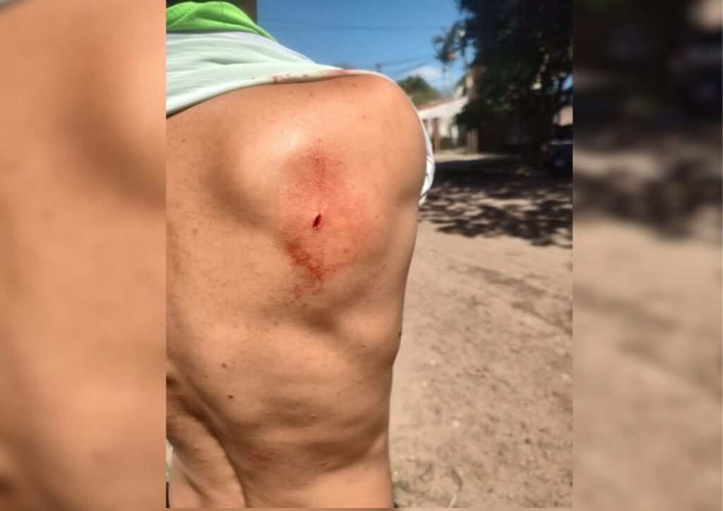 Barranqueras: le secuestraron la moto por falta de papeles y apuñaló en la espalda a un inspector
